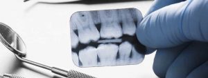 اهمیت رادیولوژی دندان چیست