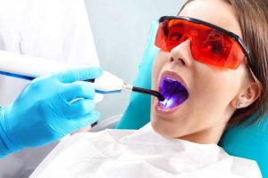 لیزر دندانپزشکی