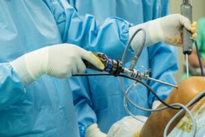 جراحی روباتیک زانو